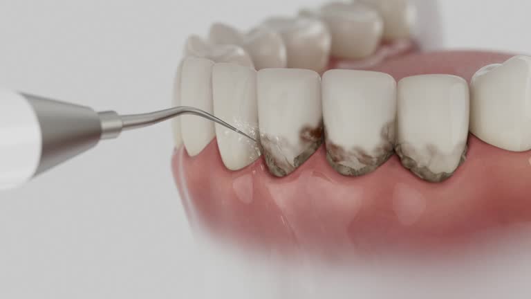 Reliable Dental Implants contractor in Falling Water, TN by Smile Center Dentistry